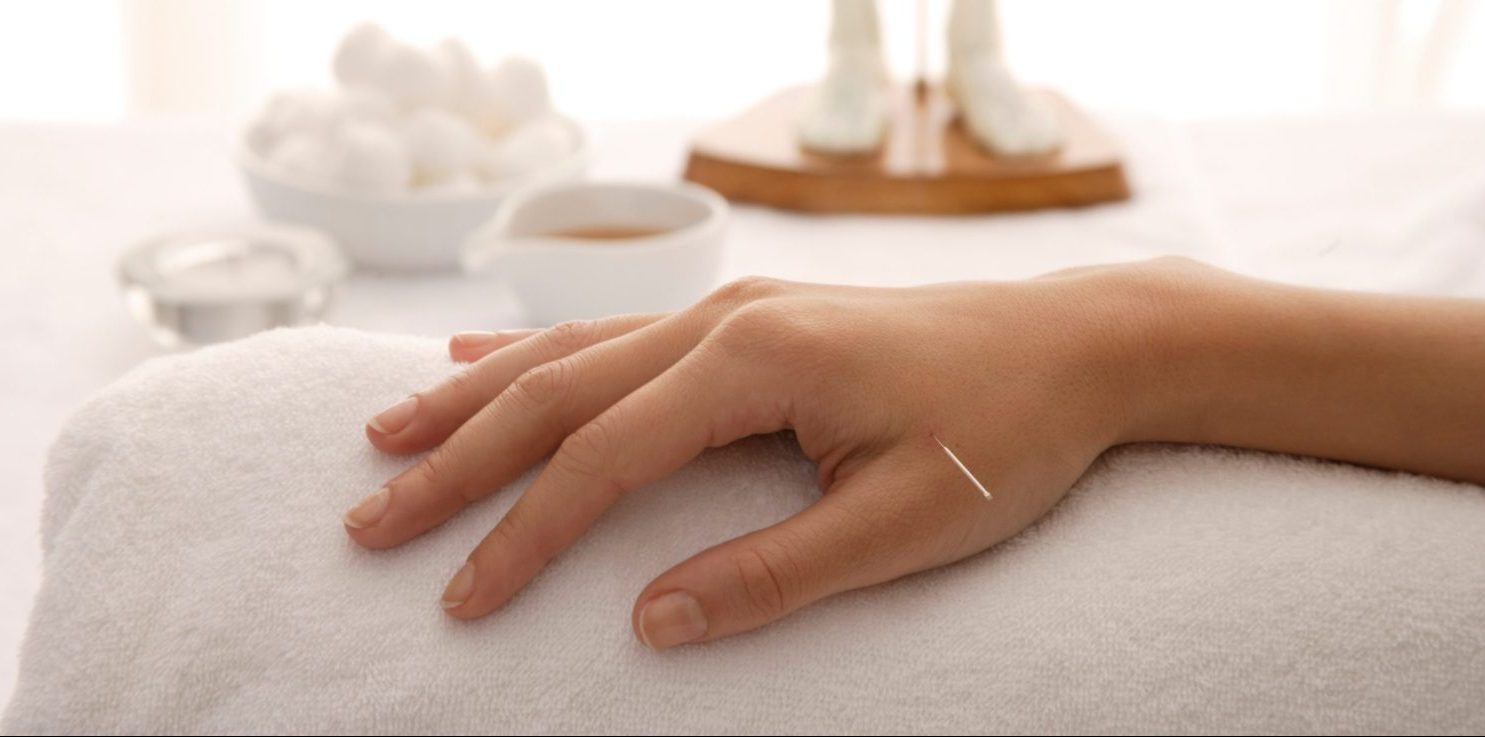 bienfaits acupuncture